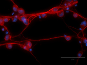 Neurons created in the Sell lab from human fibroblasts